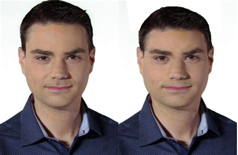 Fetal Alcohol Syndrome Adults Face