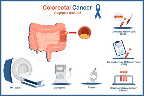Image result for Colon Cancer Testing