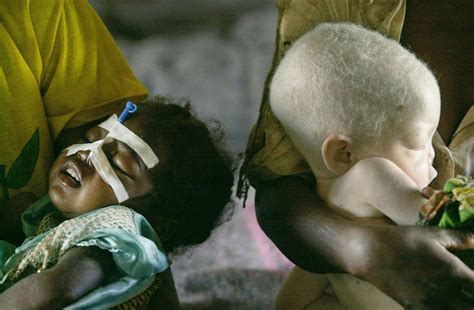 15 illnesses that have led to discrimination in history