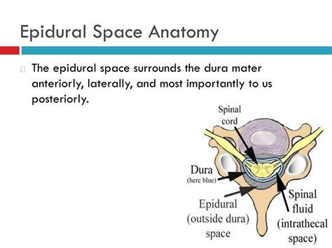 PPT - Neuraxial Blockade Essentials: Anatomy, Techniques, and Complications PowerPoint ...