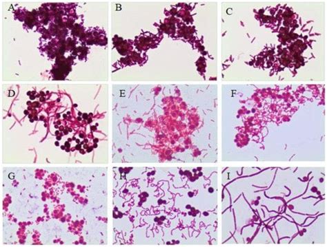 In Vitro Inhibitory Effects and Co-Aggregation Activity of Lactobacilli ...