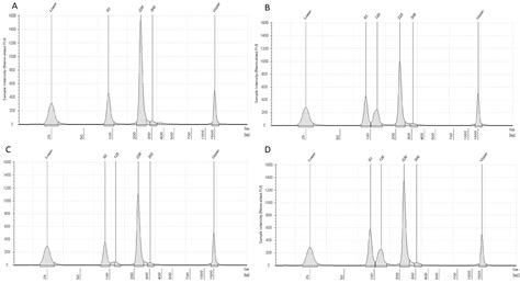 G6PD Potenza: A Novel Pathogenic Variant Broadening the Mutational ...