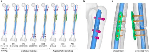 Mechanical evaluation of revision surgery for femoral shaft nonunion ...