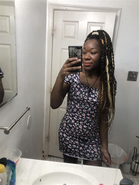 25f bothered by laugh lines, under eyes and upper lip. Feel it ages me, thinking to get filler ...