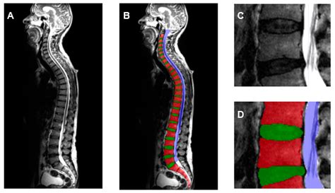 Application of a Deep Learning Approach to Analyze Large-Scale MRI Data ...