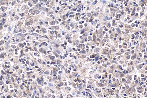 TAF15 antibody (24235-1-AP) | Proteintech