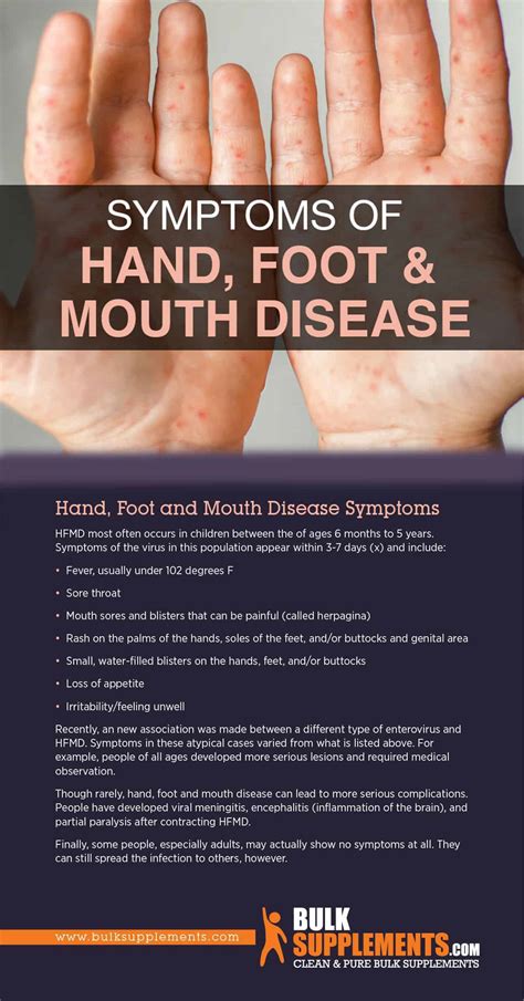 How Is Hand Foot And Mouth Disease Started at Damon Larmon blog