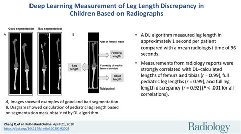 Measure Leg Length Discrepancy 的图像结果