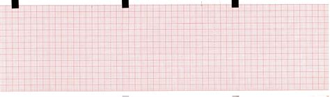 Ecg Paper 80mm X 90mm X 360sheet Works For Hellige | Desertcart INDIA
