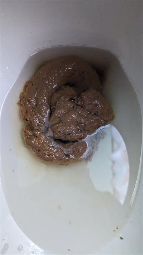 Pancreas issues or colon cancer or??? : r/poop