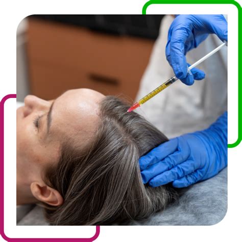 GFC, PRP – for Hair Loss – Regrow