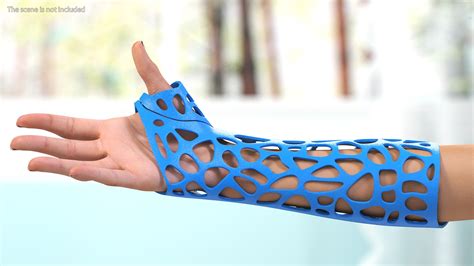 3D 3D-Printed Orthopedic Cast On Hand - TurboSquid 1900345