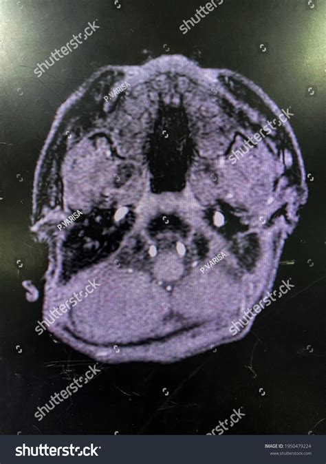 169 Watershed Images Images, Stock Photos & Vectors | Shutterstock