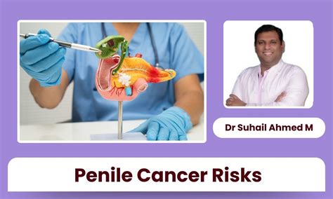 Penile Cancer: Role of Hygiene, Smoking & Sexual Health Habits - Dr ...