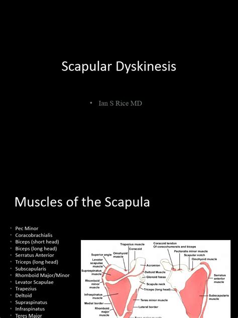 Image result for Scapular Rotation Dysfunction