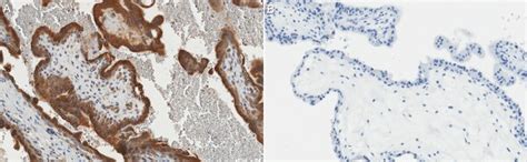 Anti-VEGF Antibody | ABS82