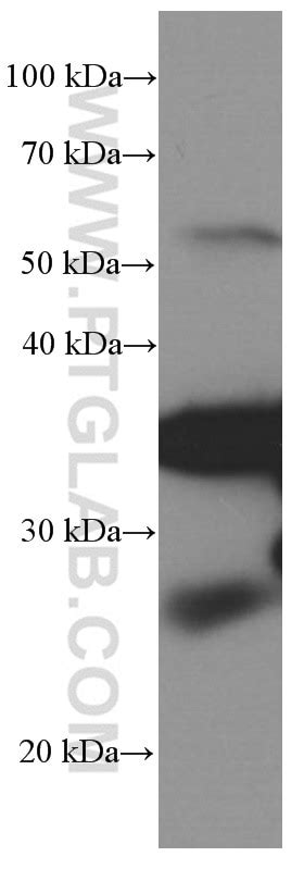 PD-1/CD279 antibody (66220-1-Ig) | Proteintech