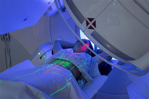 Radiation Therapy: MedlinePlus
