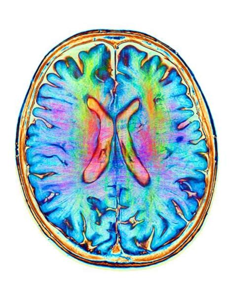 High Res Brain Scan Image 的图像结果