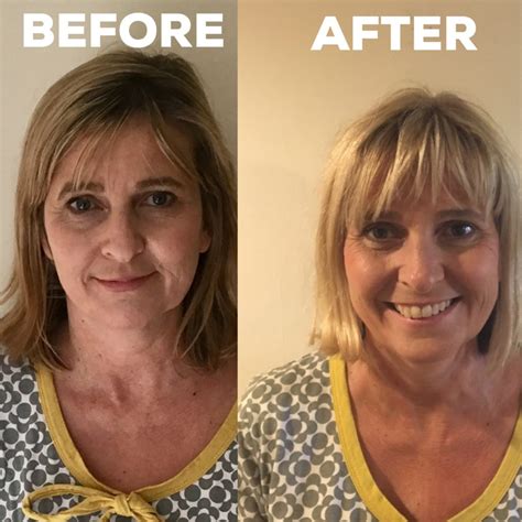 How quitting drinking effects your skin | What does alcohol do to your ...