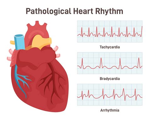Lifestyle Modifications for Managing Arrhythmia | The Harley Street
