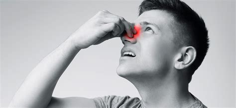 Atrophic Rhinitis (Ozaena): What Is It, What Causes It, How Is It ...