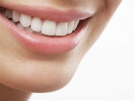 Discover more about the meaning of dental veneers and what are their ...