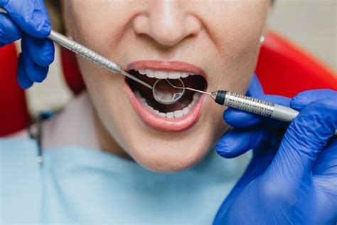 Tooth Extraction 的图像结果