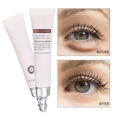 20g Best Eye Cream Serum For Dark Circles Puffiness Under Eye Reduce Fine ~ Tormented Fyodorova