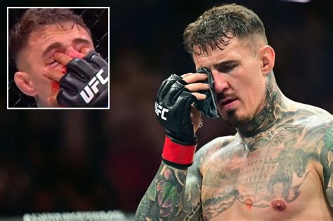 Tom Aspinall to Undergo Eye Surgery Following Loss to Gane: Injury Details - all the latest news ...