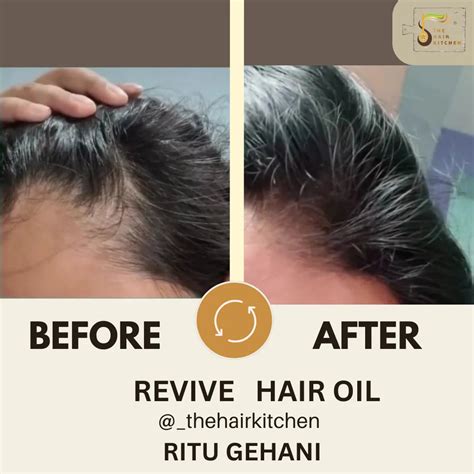 REVIVE HAIR OIL (30ml / 120ml)