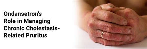 Ondansetron's Role in Managing Chronic Cholestasis-Related Pruritus