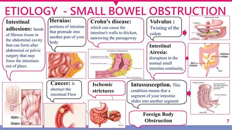 BOWEL OBSTRUCTION.pptx