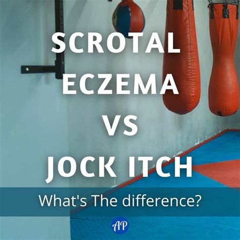Scrotal Eczema vs Jock Itch: What's The Difference?