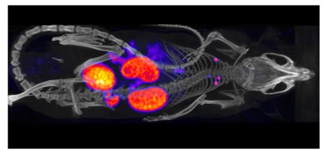 Hybrid Imaging for Patient-Specific Dosimetry in Radionuclide Therapy