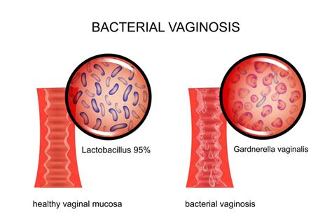 7 Top Reasons behind Itchy Clitoris and How to Solve Them