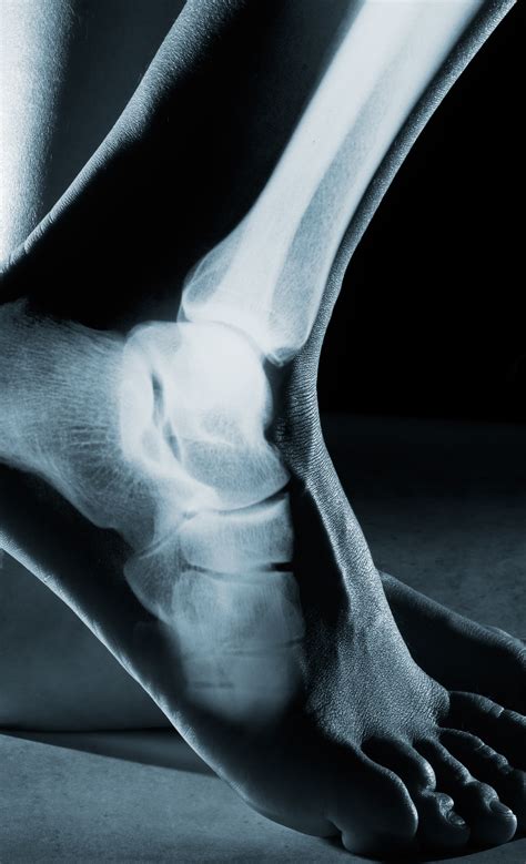 Understanding Ankle Bone Growth and Development - DiabeticShoe.in