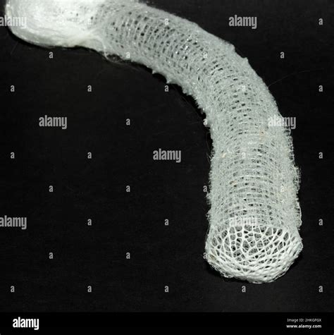 Sponge Skeleton Cross Section