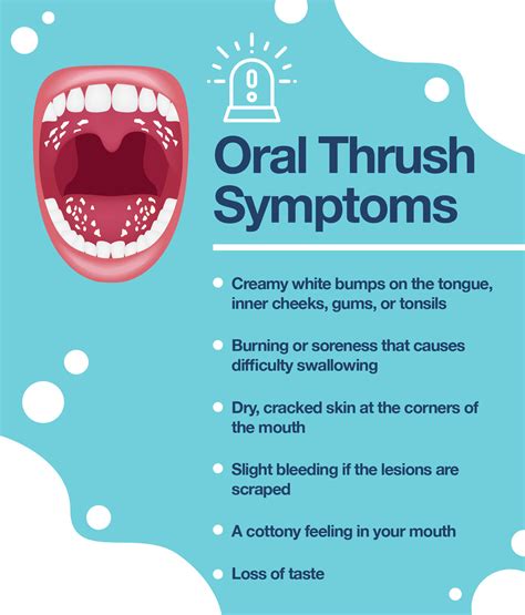 How To Cure An Oral Yeast Infection - Buildingrelationship21