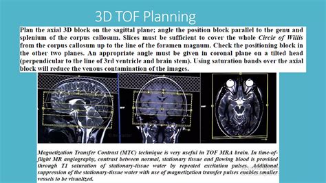 Magnetic Resonance Angiography and Venography | PPTX