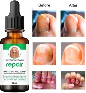 MILAN Enterprise nail growth oil/nail growth serum Nail Treatment ...