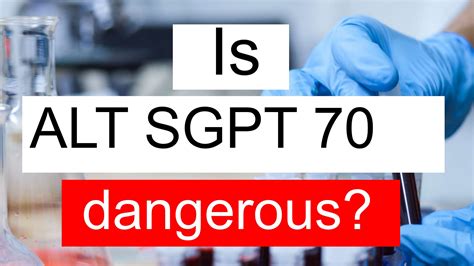 Is ALT SGPT 70 normal, high or low? What does Alanine aminotransferase level 70 mean?