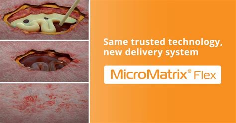 Image result for Micro Matrix Flex