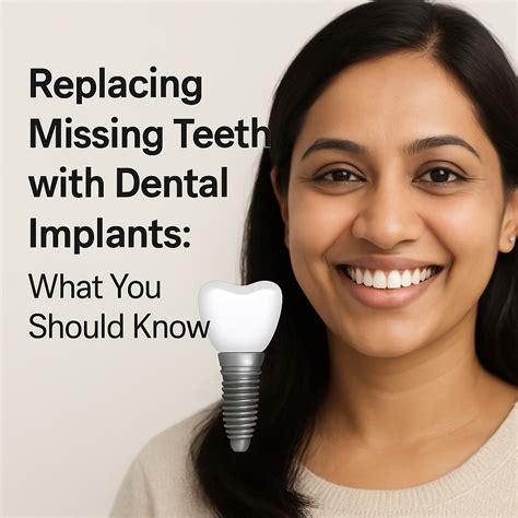 Long-Term Solution for Missing Teeth: Understanding Dental Implants