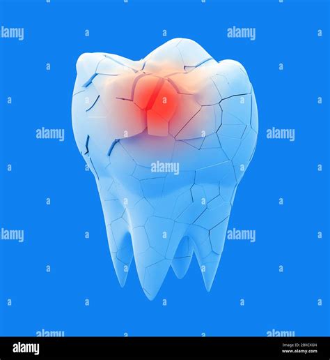 Broken molars tooth and whole tooth isolated on white background. 3d illustration Stock Photo ...