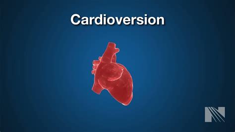 Image result for Cardioversion Steps