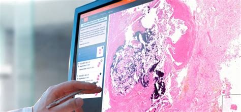 Image result for WinPath Pathology System