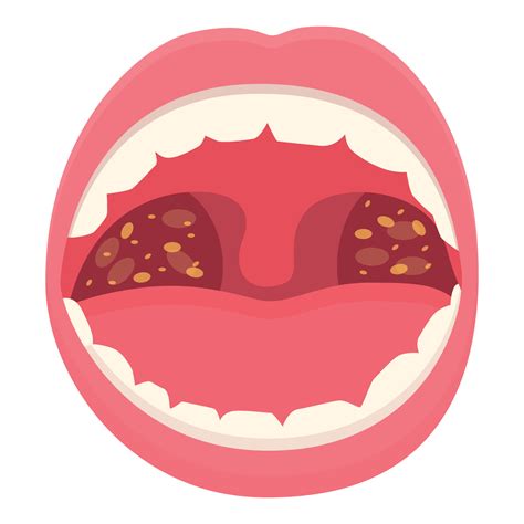 Medical pain mouth icon cartoon vector. Throat health 21524647 Vector ...