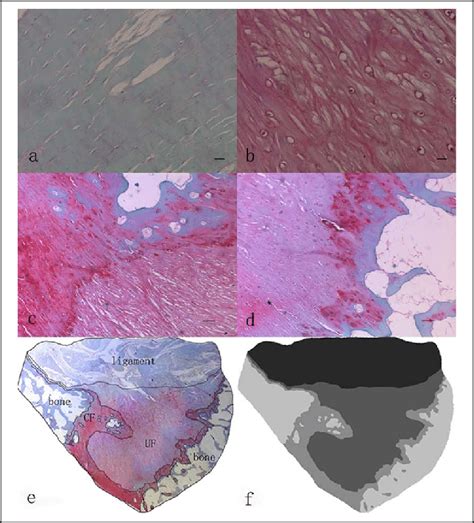 Spindle Shape 的图像结果