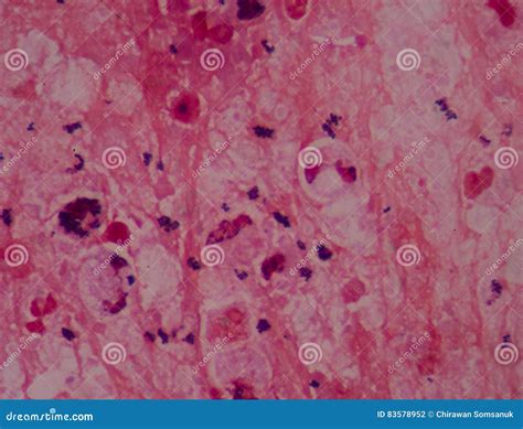 Gram Stain Gram Positive Cocci Stock Photography | CartoonDealer.com ...
